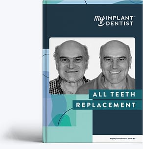 Dental Implants Sydney Ebook