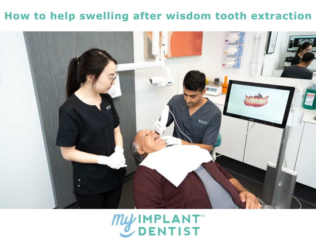 my implant dentist - wisdom tooth extraction