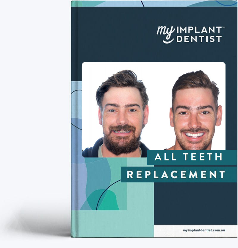 my implant dentist - Dental implant Perth
