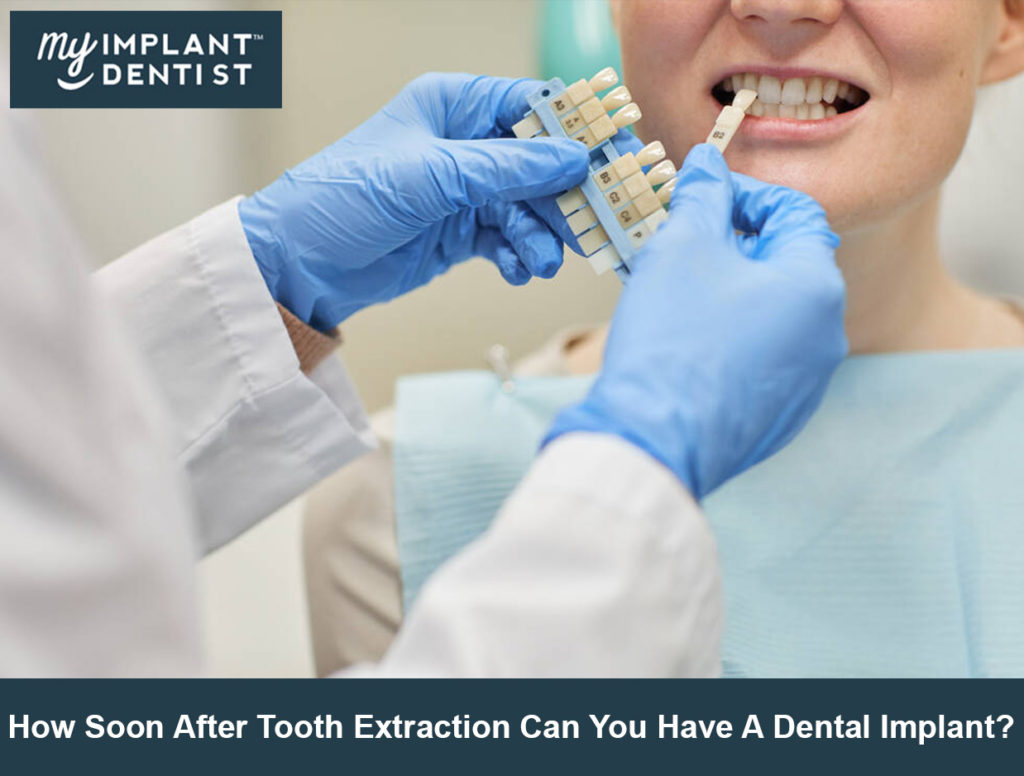 dental implant after tooth extraction