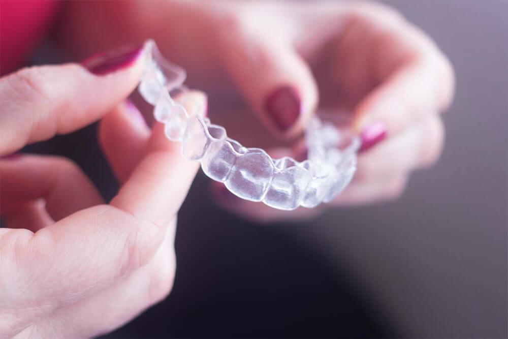 Best Invisalign treatment in Perth