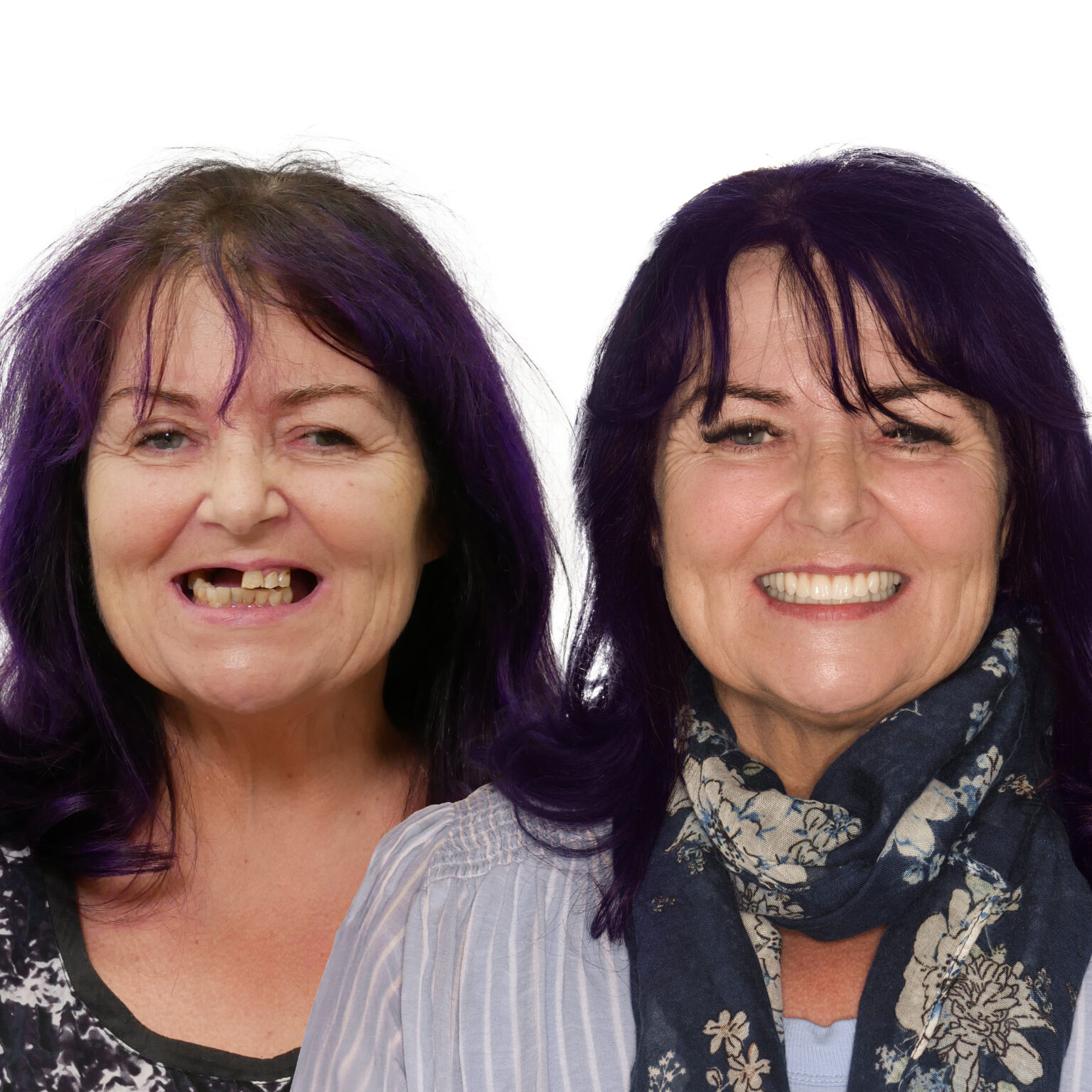 Affordable Dental Prices - Kedron