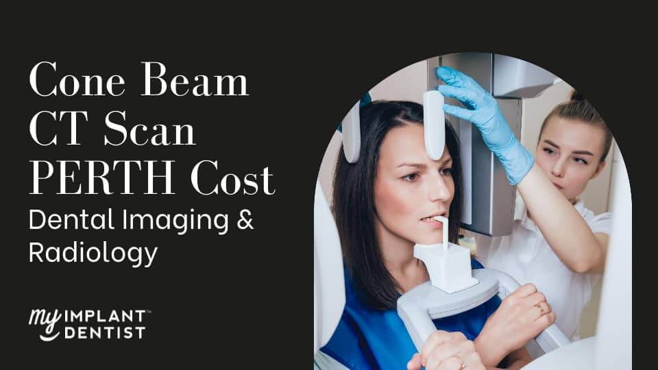 Cone Beam CT Scan PERTH Cost - Dental Imaging & Radiology