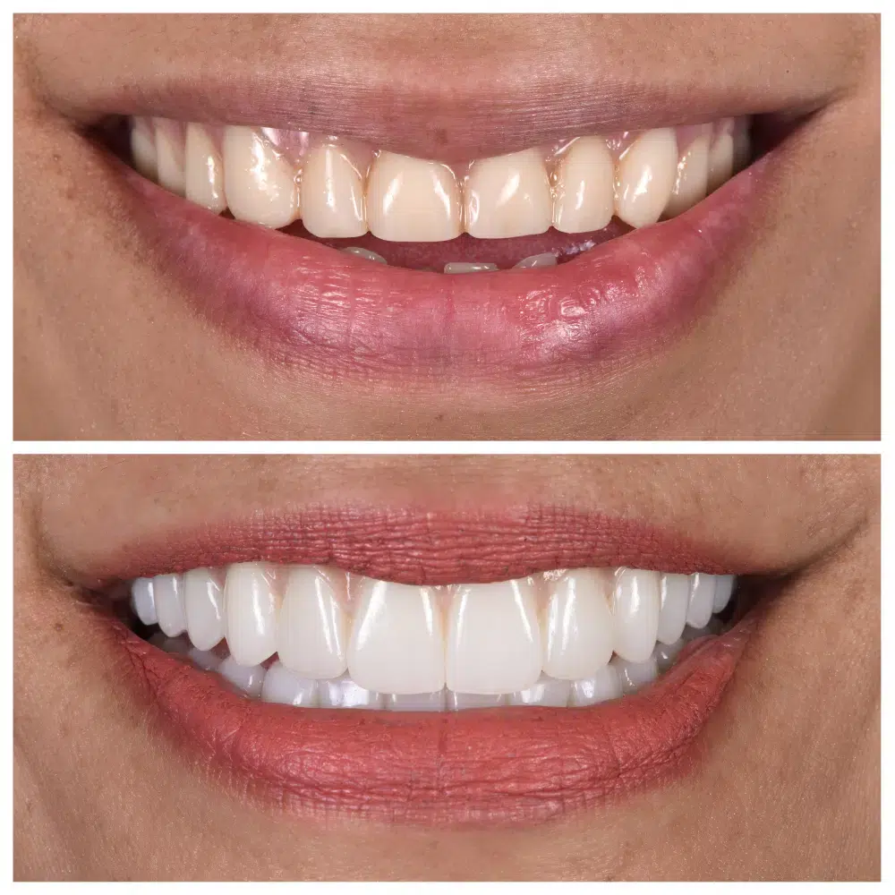 Cosmetic Dentist Melbourne
