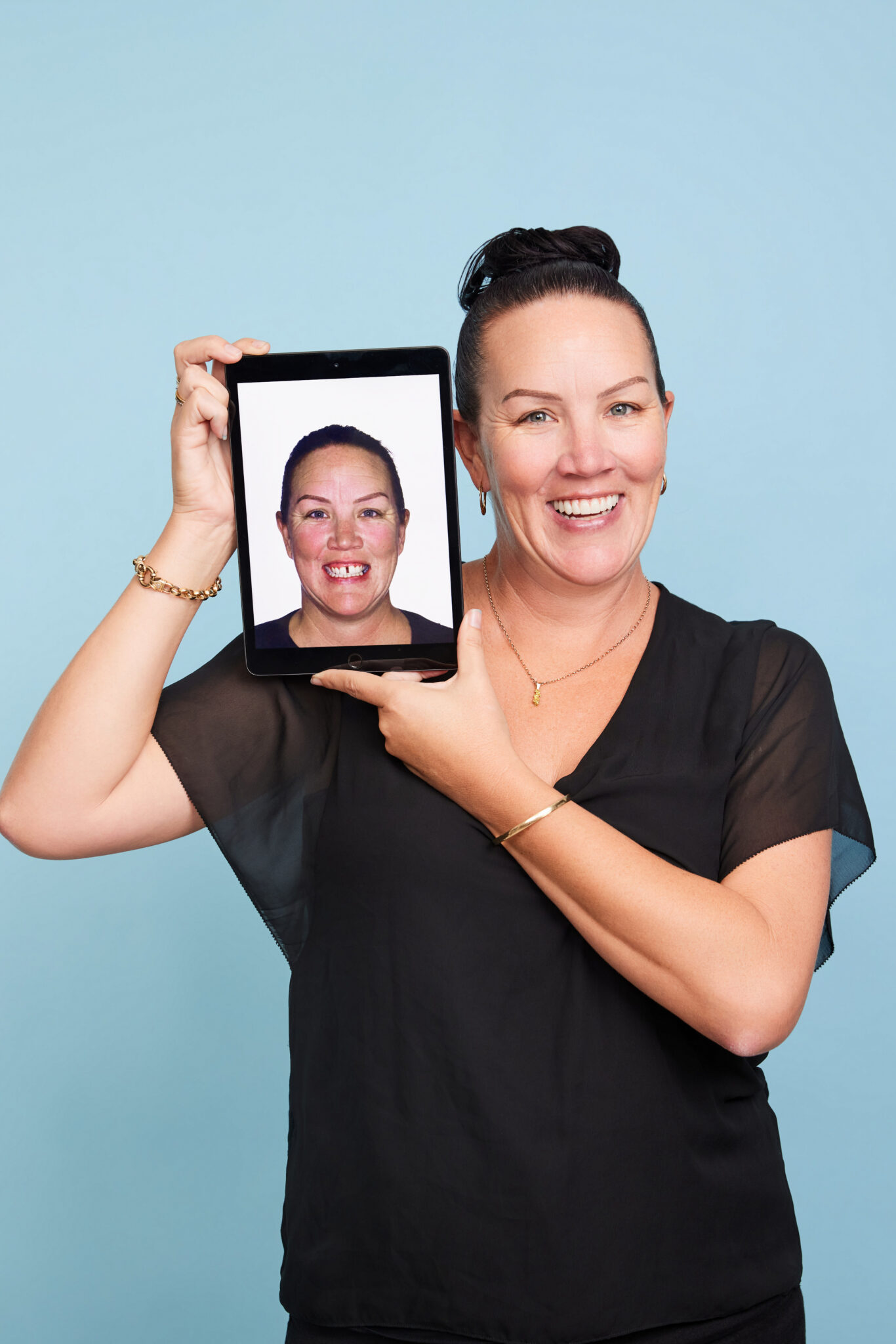 Cost of Dental Implants Near Geraldton Australia