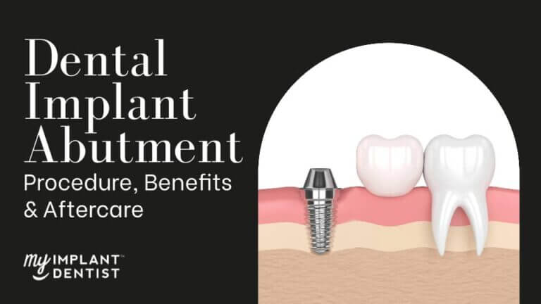 Dental Implant Abutment - Procedure, Benefits & Aftercare