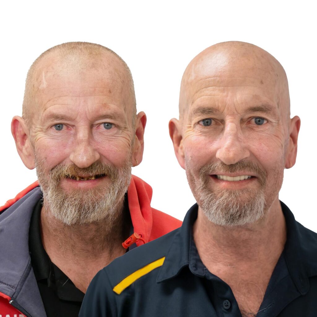 Dental Implants Safe For The Elderly In Perth