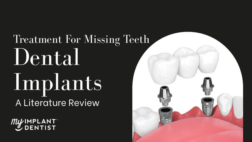 Dental Implants as a Treatment For Missing Teeth A Literature Review