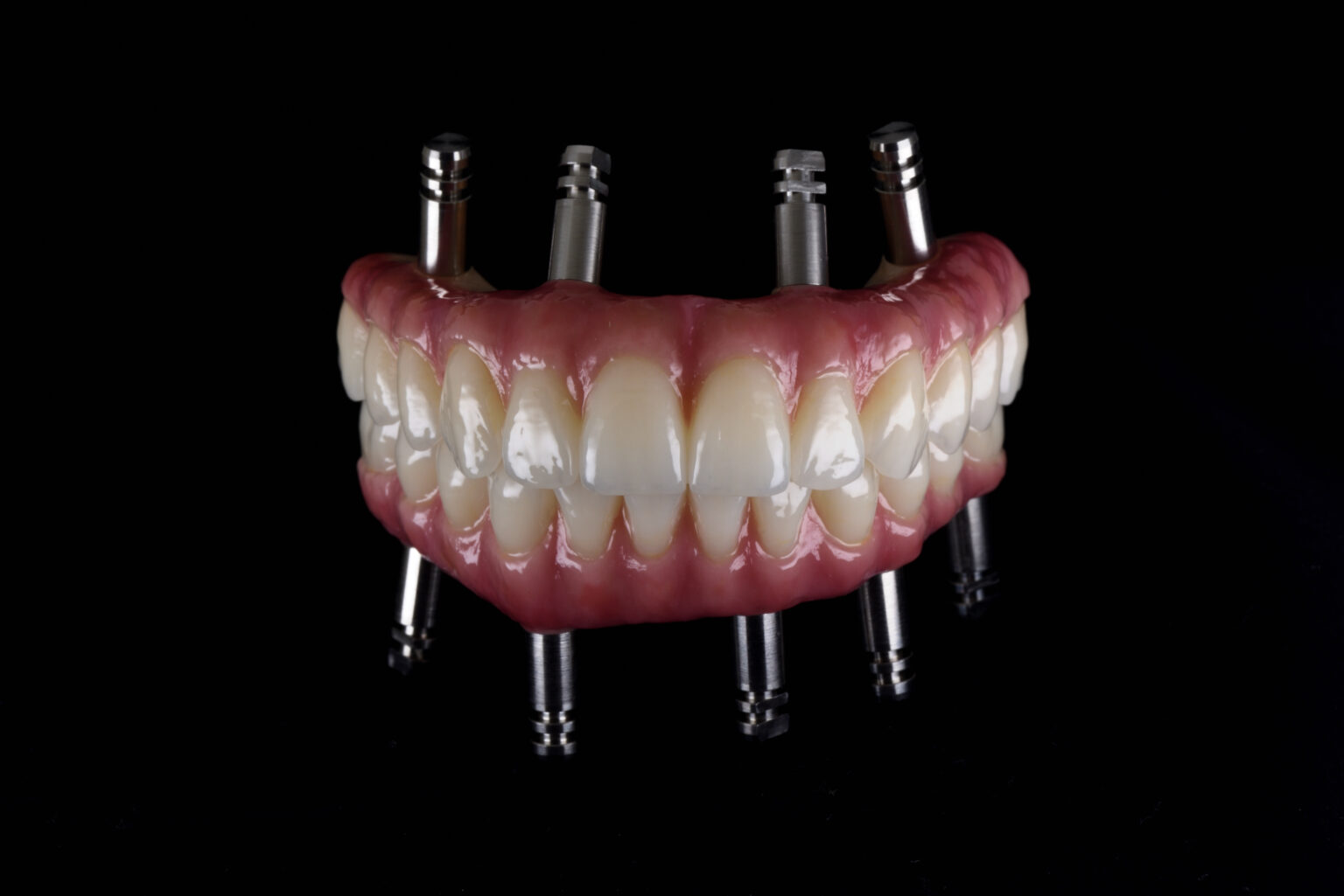 Do Ceramic Implants Work