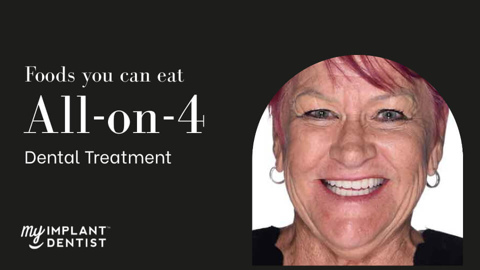 Does Food Get Under All-on-4 Dental Implants