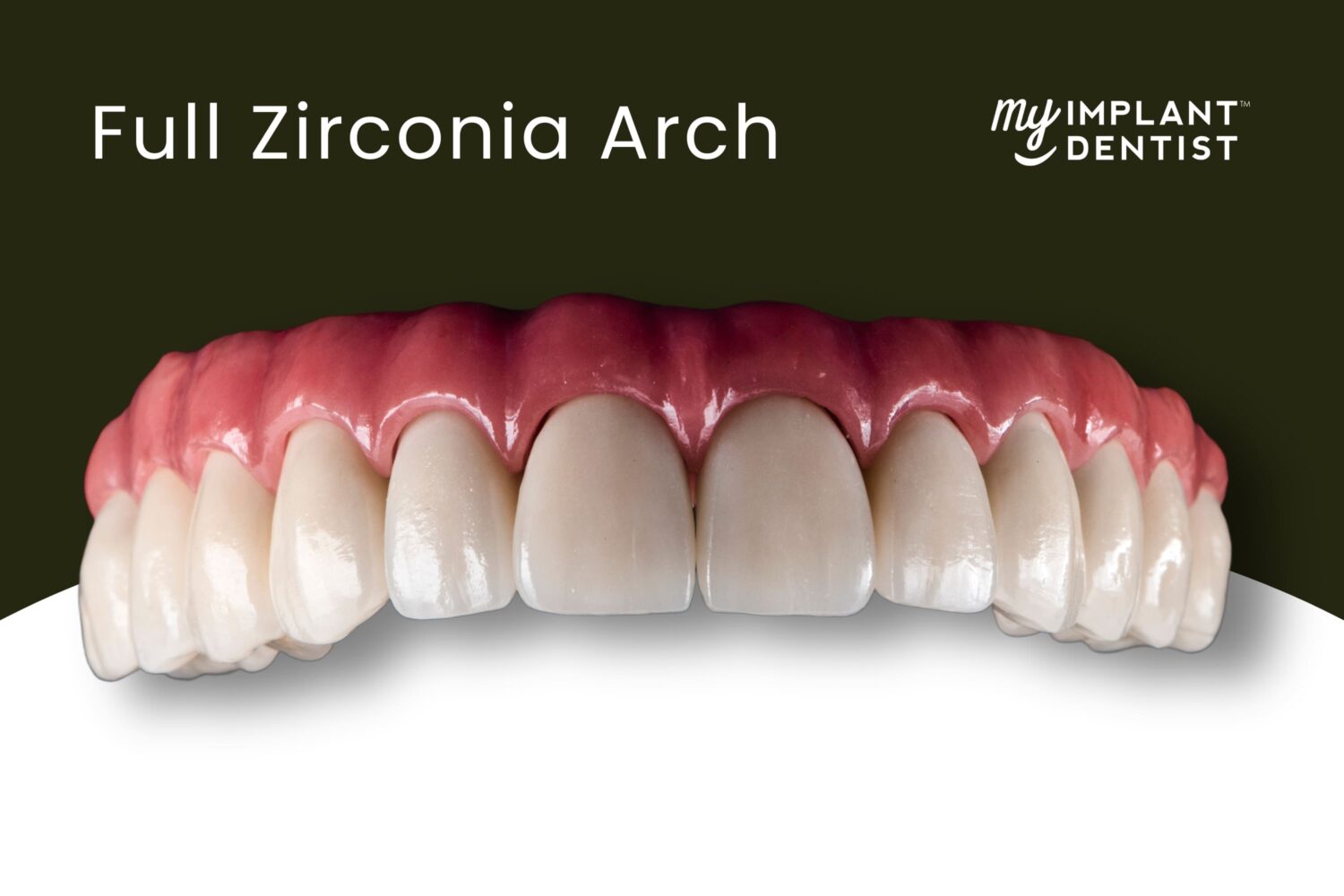 Full Zirconia Arch Dental Implant