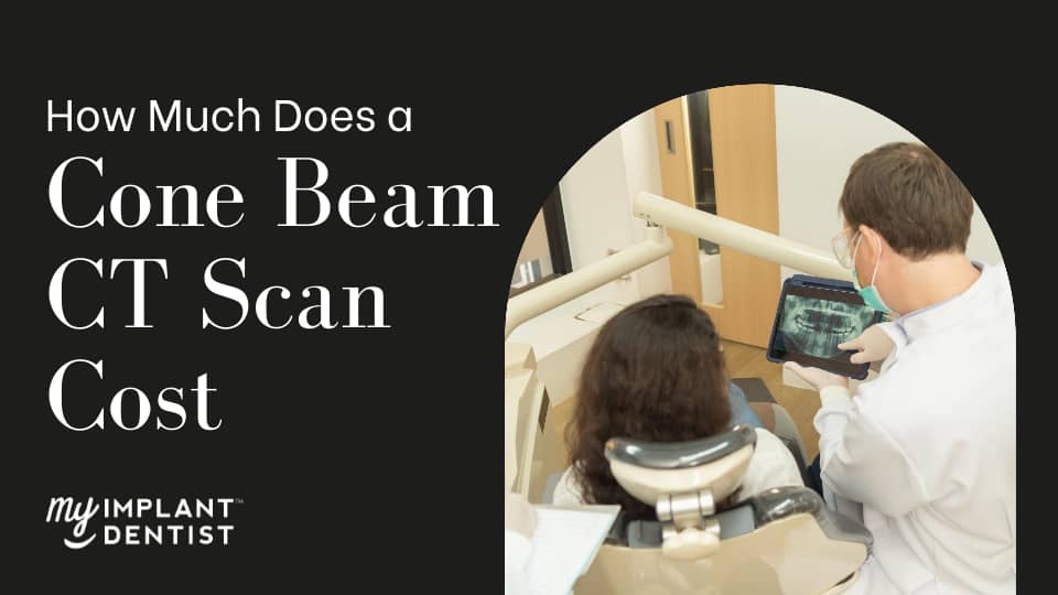 How Much Does a Cone Beam CT Scan Cost
