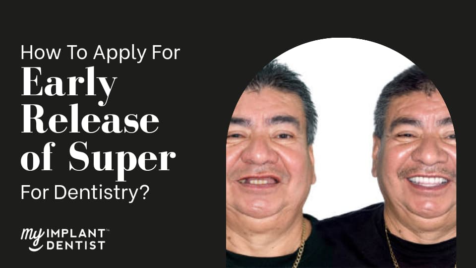 How To Apply For Early Release Of Super For Dentistry?