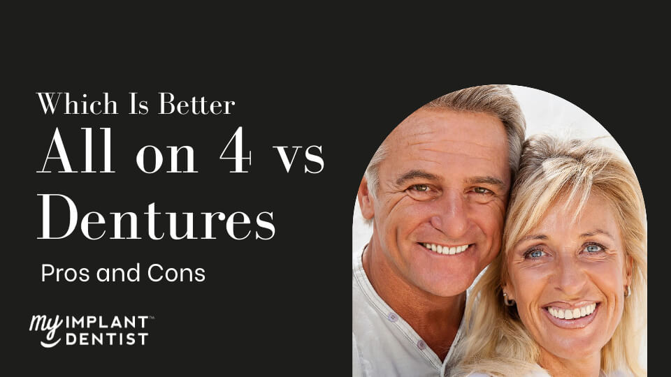 How are All-on-4 Dental Implants different from dentures?