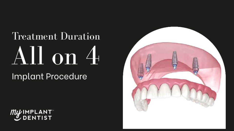How long does an All-on-4 Procedure take