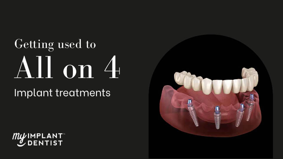 How long does it take to get used to all on four dental implants