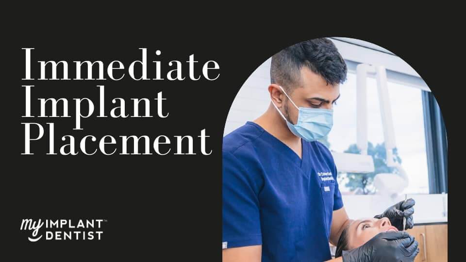 immediate dental implant placement cost