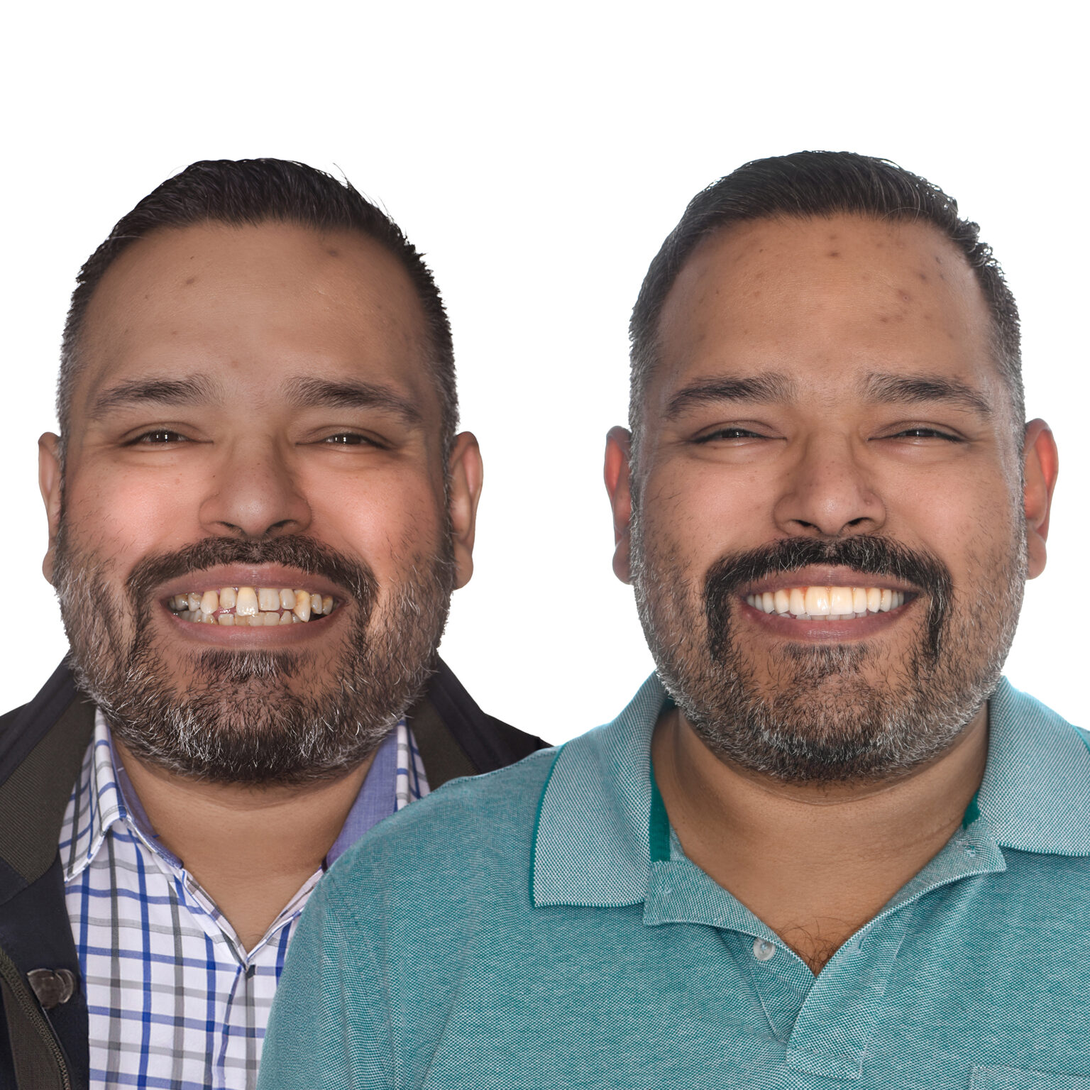 Perth Teeth Implant Resources