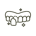 Porcelain Veneers