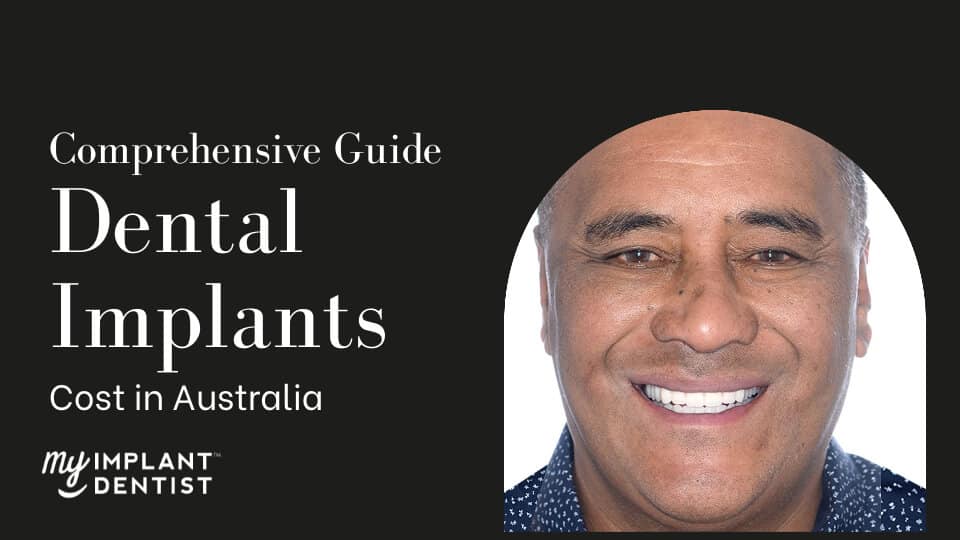 The Comprehensive Guide to Dental Implants Cost in Australia