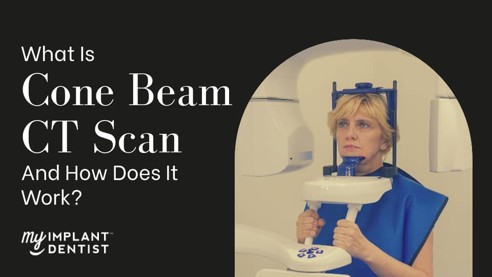 What Is Cone Beam CT Scan And How Does It Work