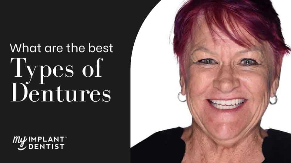 What are the best types of dentures