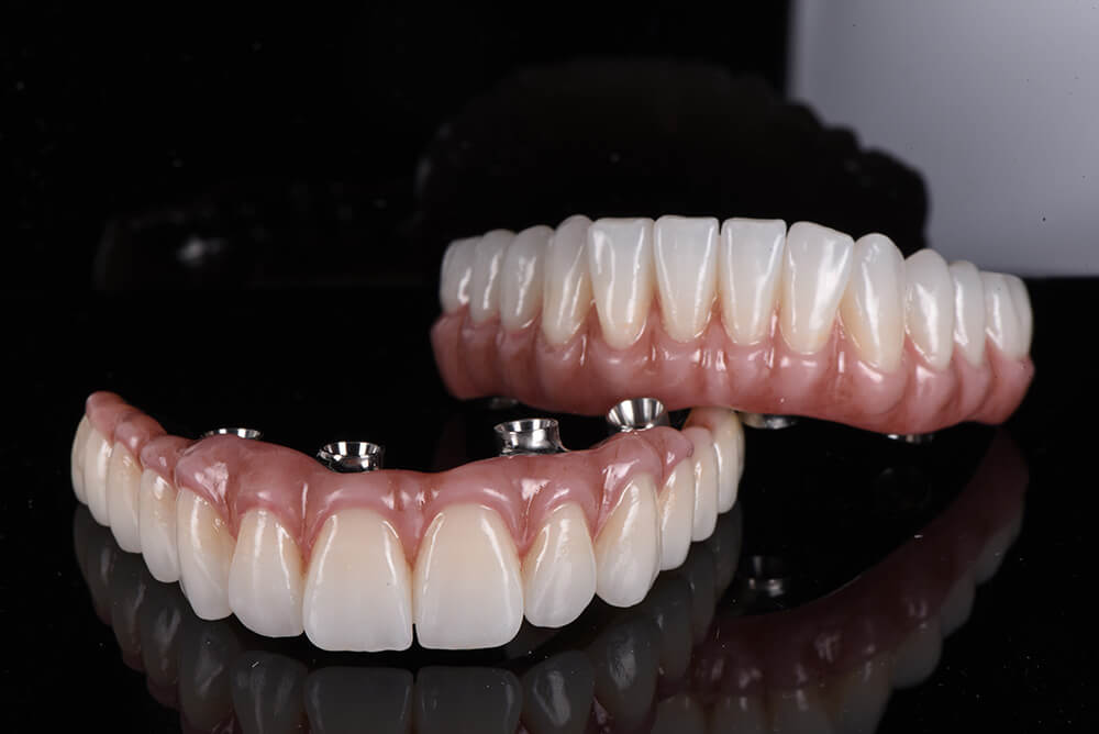 dental crown treatment melbourne