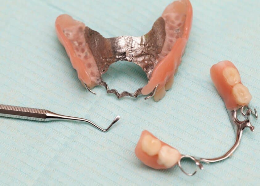 dental prostheses