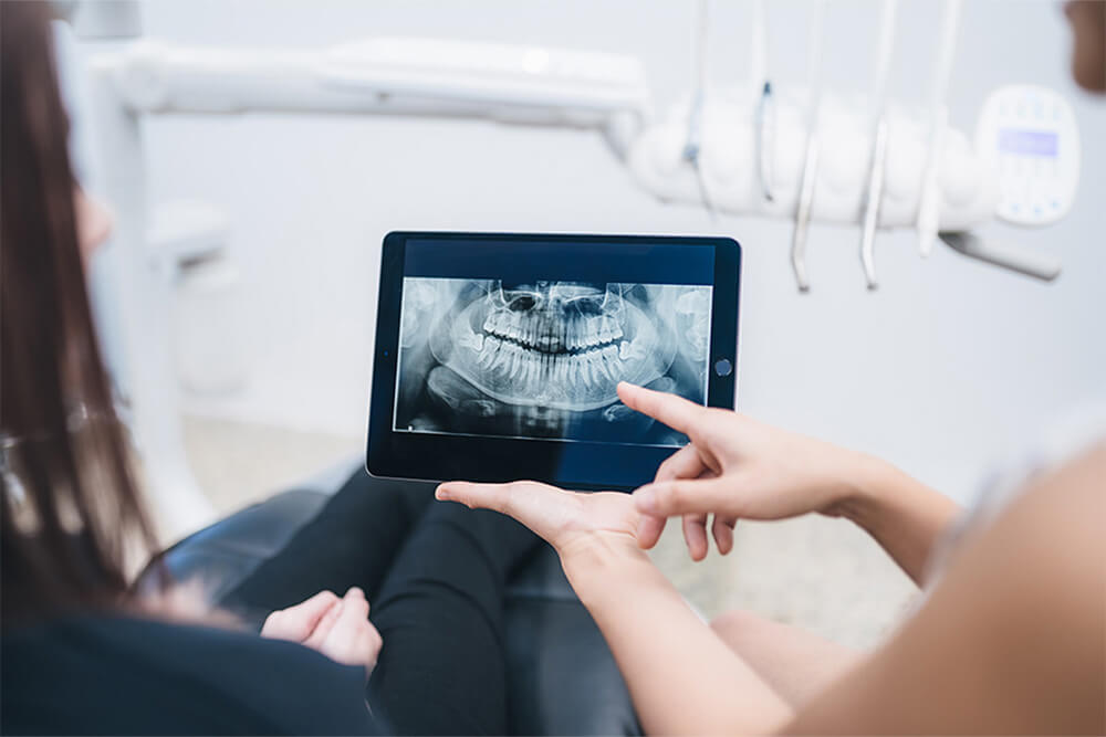 wisdom teeth removal in Perth